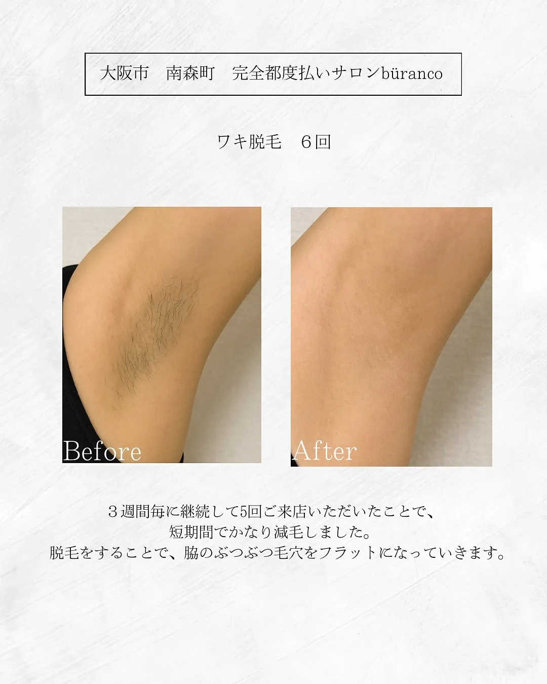 @buranco_beauty 自力で-5歳を目指す大人の根...