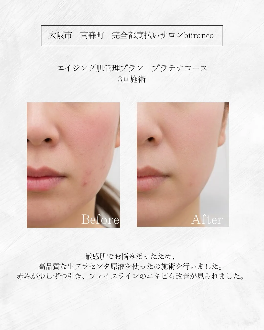 《完全都度払いサロン büranco》